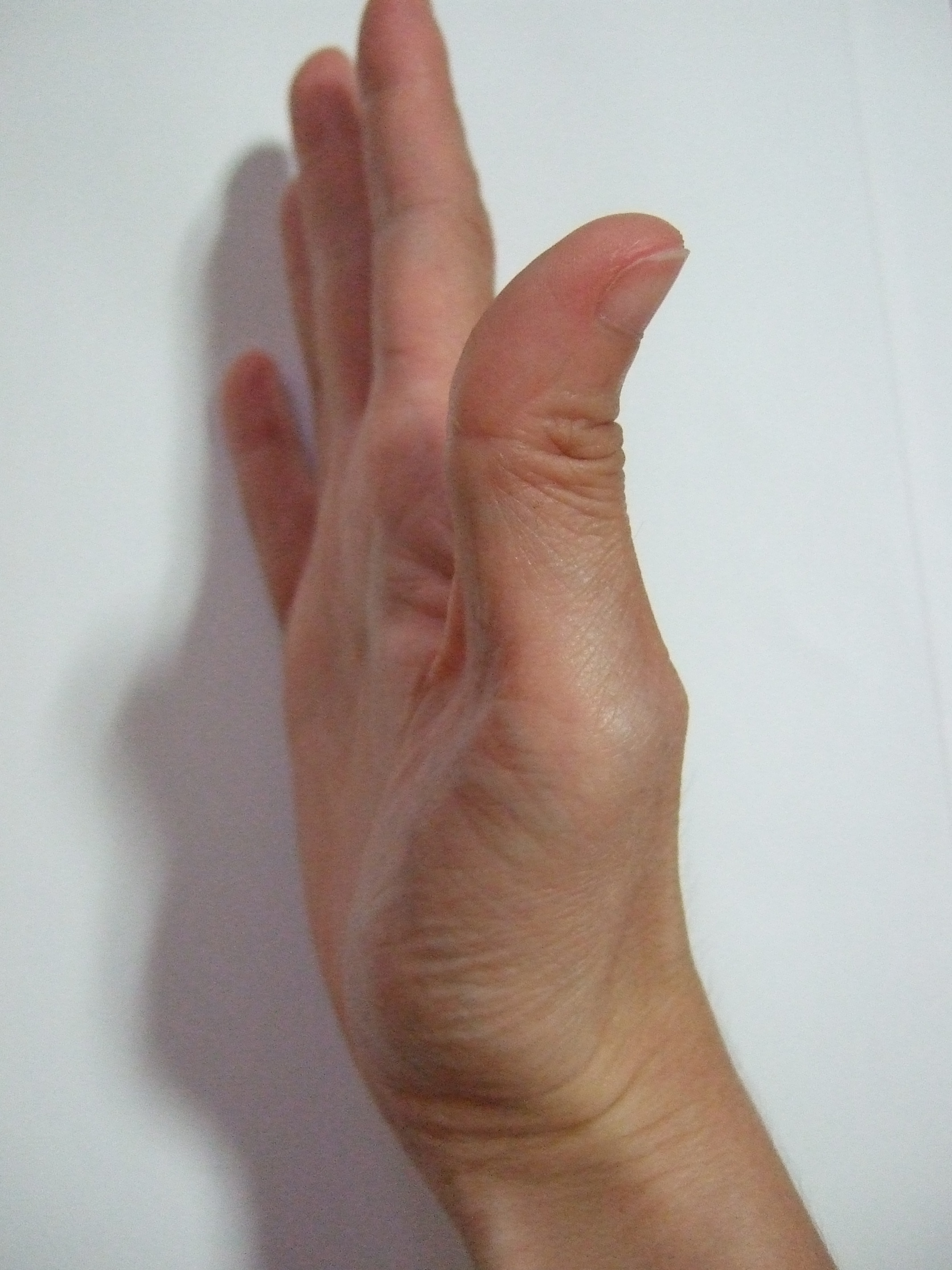 right - side 2.JPG